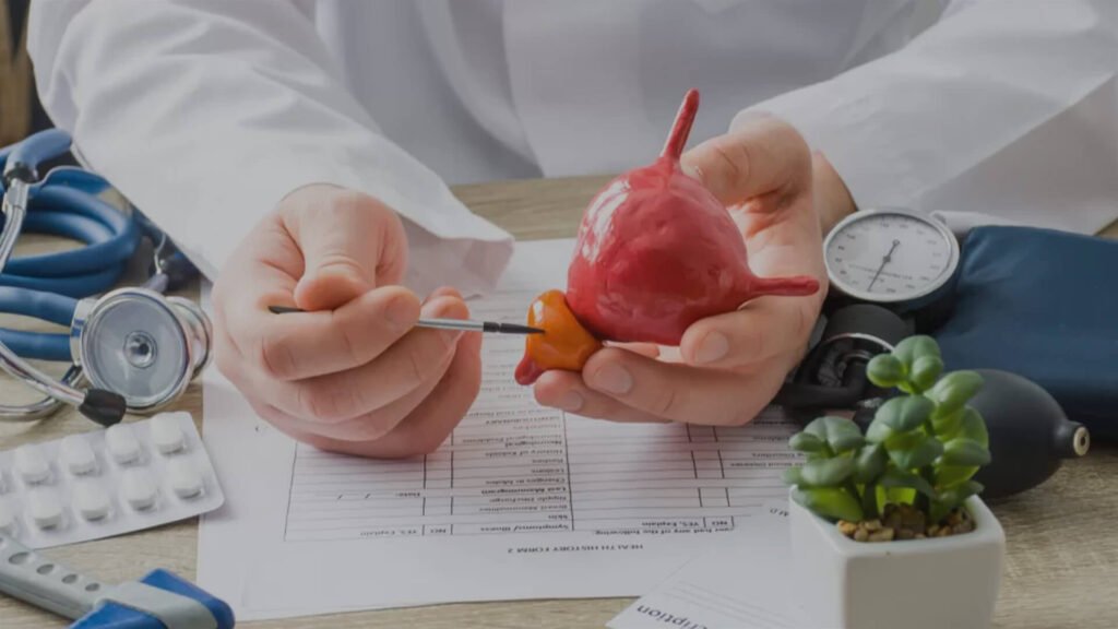 Adenomul de prostata. Ce este? Cauze, simptome, diagnostic si tratament